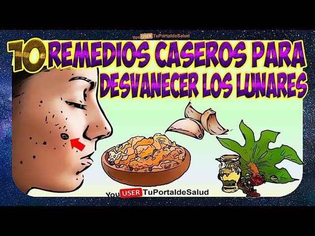 como quitarse un lunar en casa