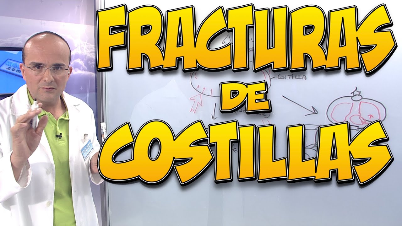 como saber si tienes una costilla rota