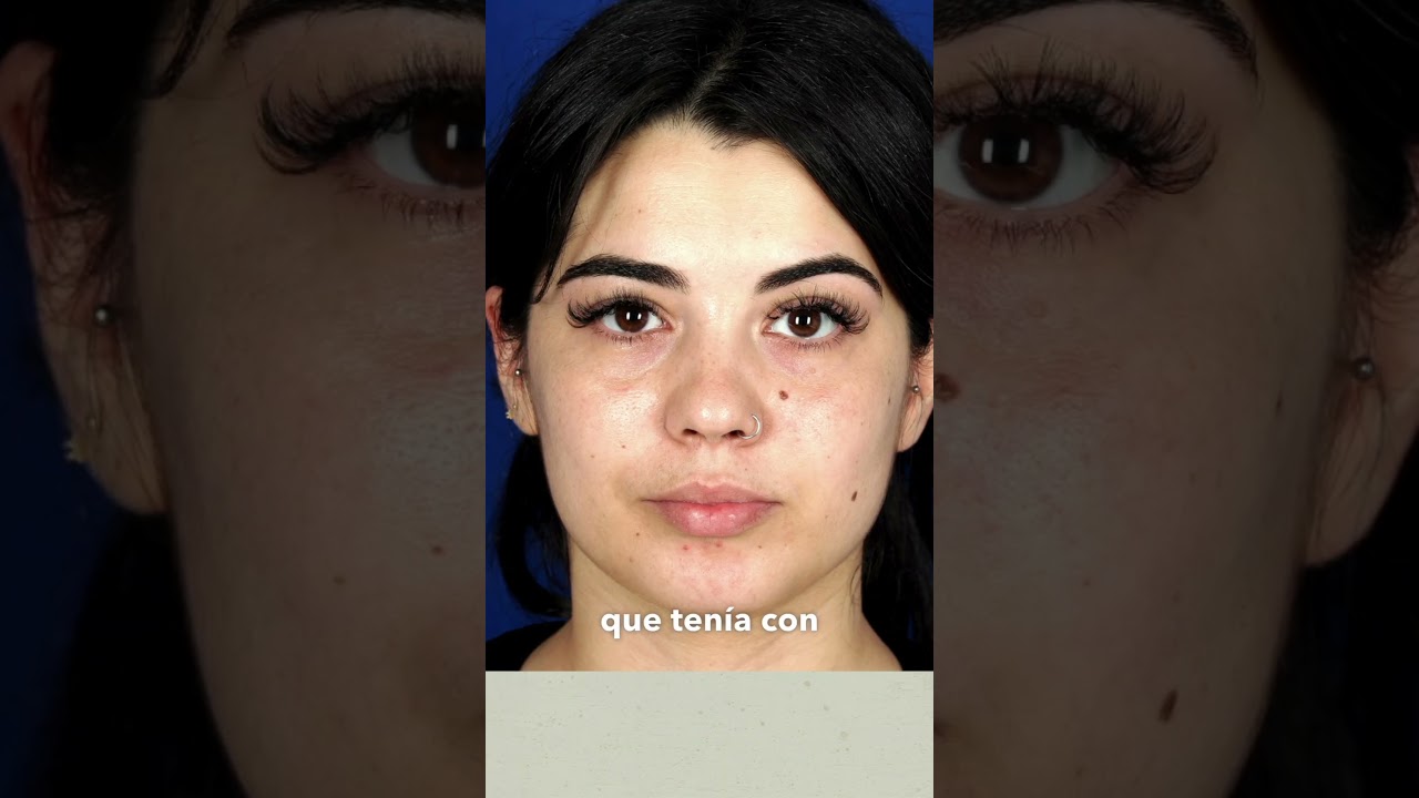 como se puede quitar un lunar