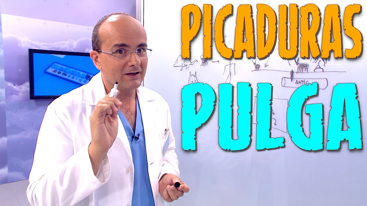 como se si tengo pulgas en casa