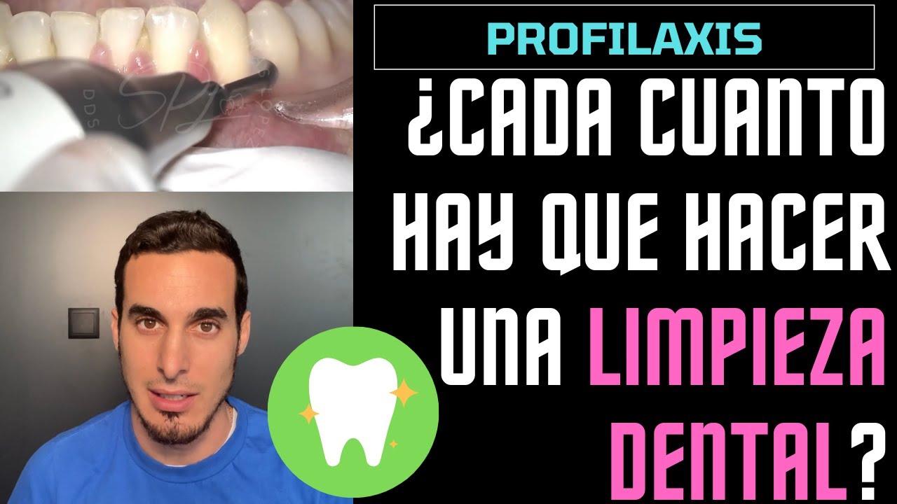cuanto puede costar una limpieza dental